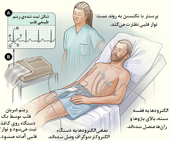 نوار قلب (ECG) چیست و چه بیماری‌هایی را نشان می‌دهد؟ با روش انجام، تفسیر ساده موج‌های نوار قلب و تفاوت آن با تست ورزش آشنا شوید.