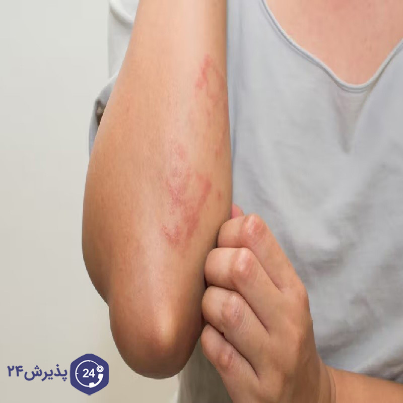 علت خارش پوست چیست؟ بررسی کامل علت‌ها، علائم و روش‌های درمان خارش پوست