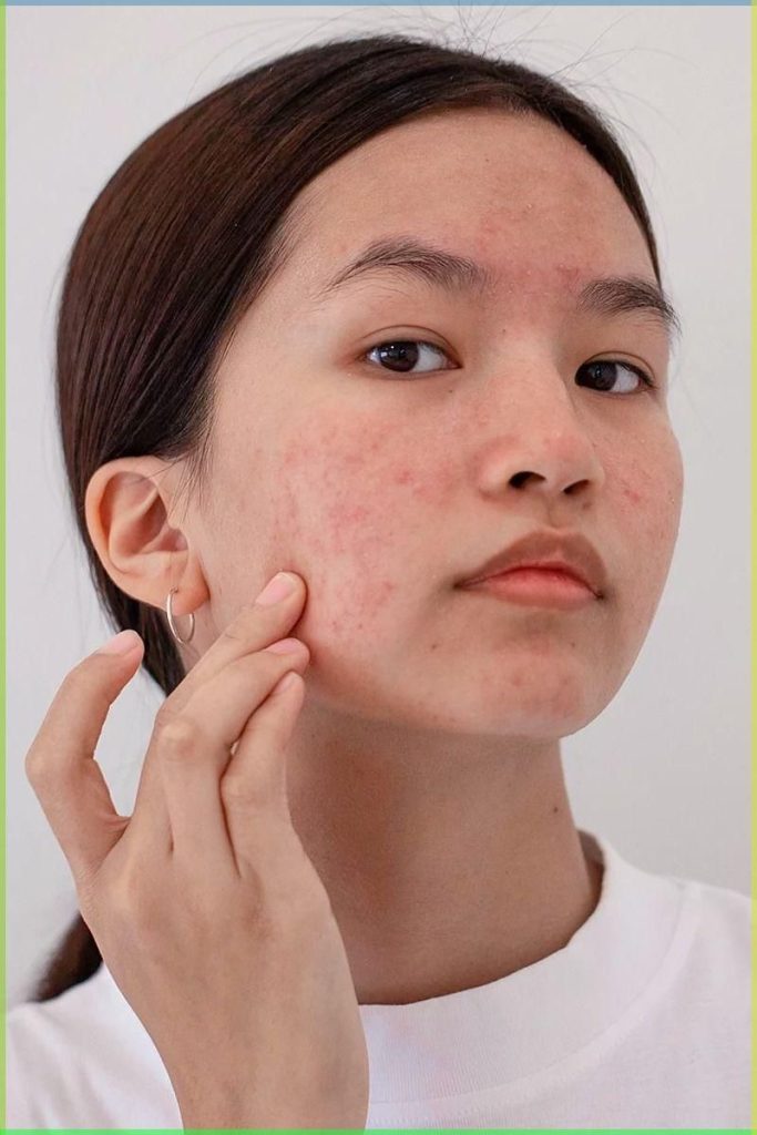 سد دفاعی پوست چیست؟ نقش Skin Barrier، علائم آسیب و روشهای علمی ترمیم