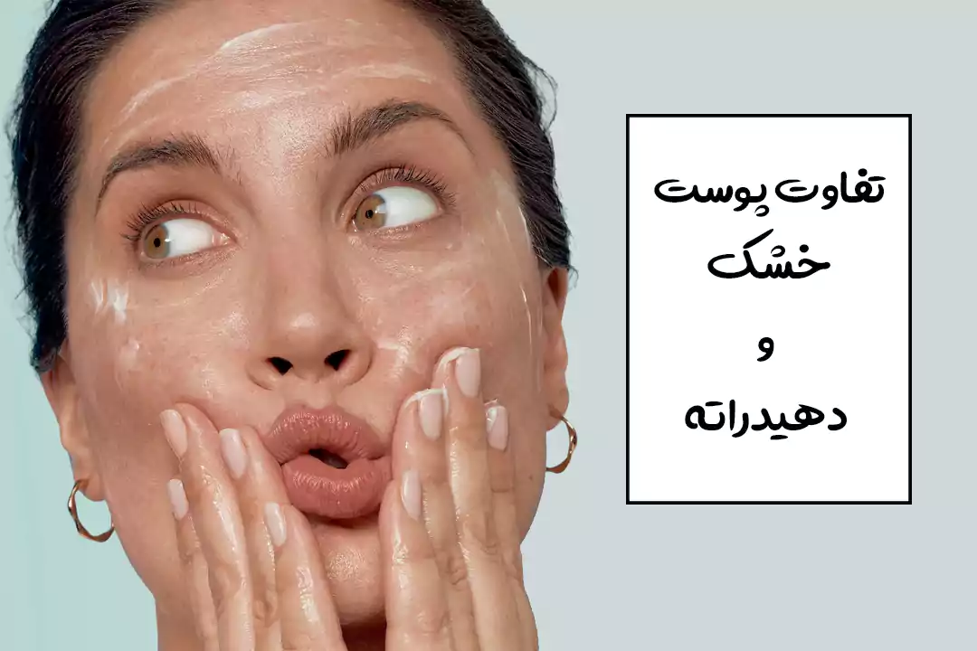 دهیدراته شدن پوست چیست؟ تفاوت پوست دهیدراته با پوست خشک و روش درمان
