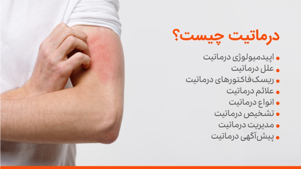درماتیت تماسی چیست؟ تفاوت نوع تحریکی و آلرژیک، علائم، علل و درمان