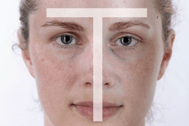 پوست مختلط چیست؟ ویژگی‌ها، علت‌ها و روتین مناسب پوست مختلط