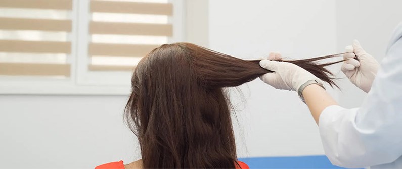 تفسیر آزمایش خون برای ریزش مو | چه آزمایش‌هایی برای بررسی علت ریزش مو لازم است؟