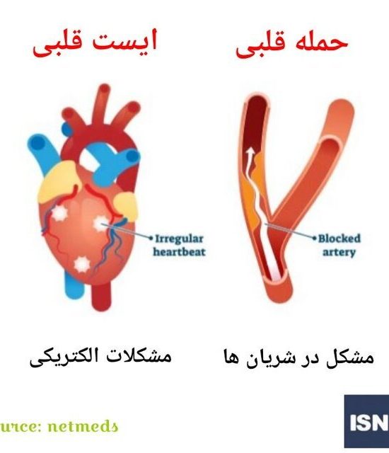 فرق سکته قلبی و ایست قلبی چیست؟ علائم، علت‌ها و اقدامات فوری