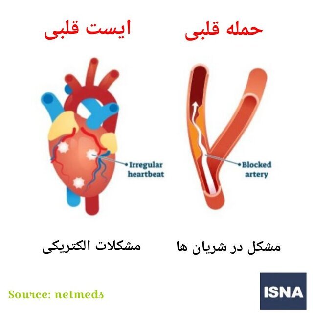 فرق سکته قلبی و ایست قلبی چیست؟ علائم، علت‌ها و اقدامات فوری