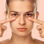 علت تیرگی زیر چشم چیست؟ بررسی جامع دلایل، پیشگیری و روش‌های درمان
