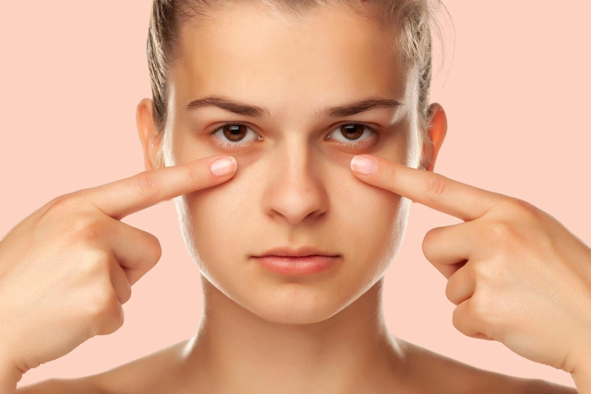 علت تیرگی زیر چشم چیست؟ بررسی جامع دلایل، پیشگیری و روش‌های درمان