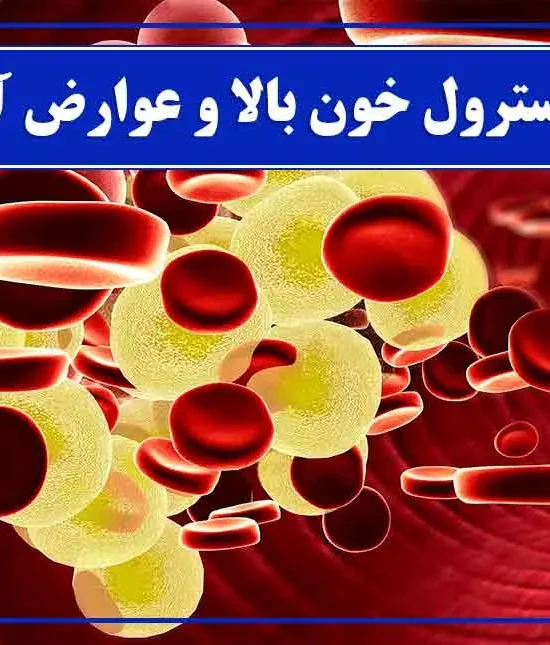 کلسترول بالا چیست؟ علائم، علت‌ها، عوارض و روش‌های کاهش آن
