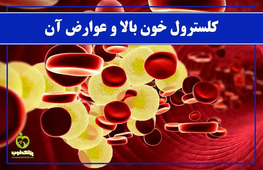 کلسترول بالا چیست؟ علائم، علت‌ها، عوارض و روش‌های کاهش آن