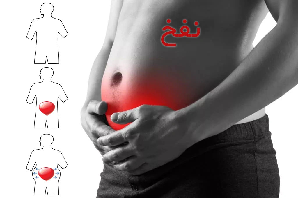 نفخ شکم نشانه چیست؟ علت‌ها، علائم، درمان و زمان مراجعه به پزشک