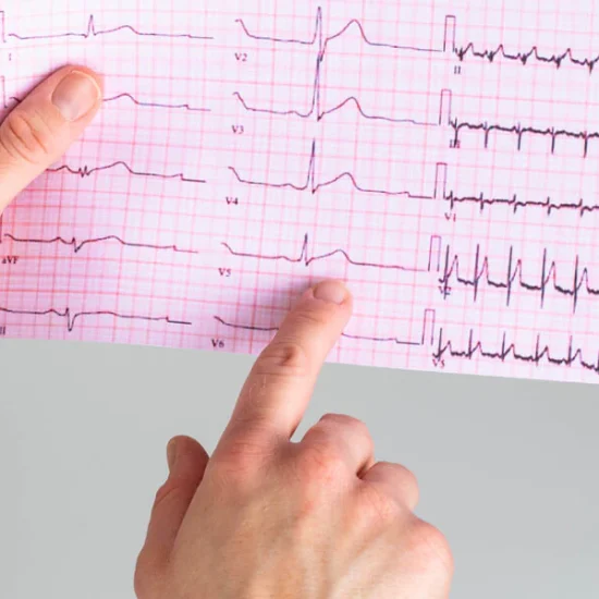 نوار قلب چیست؟ تفسیر ساده، علت انجام و بیماری‌های قابل تشخیص با ECG