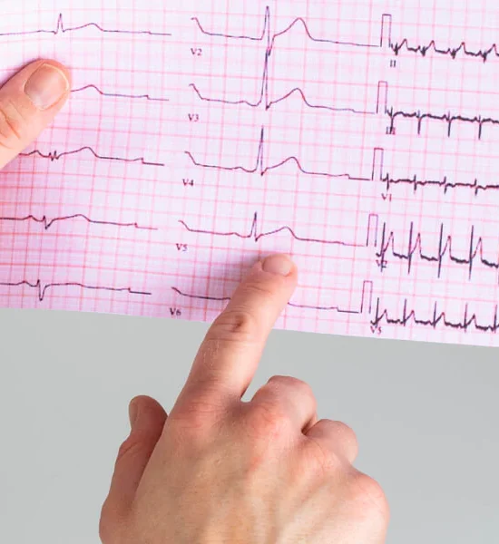 نوار قلب چیست؟ تفسیر ساده، علت انجام و بیماری‌های قابل تشخیص با ECG