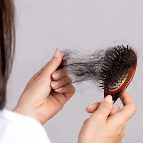 ریزش مو چیست؟ بررسی کامل علت‌ها، انواع و روش‌های جدید درمان ریزش مو