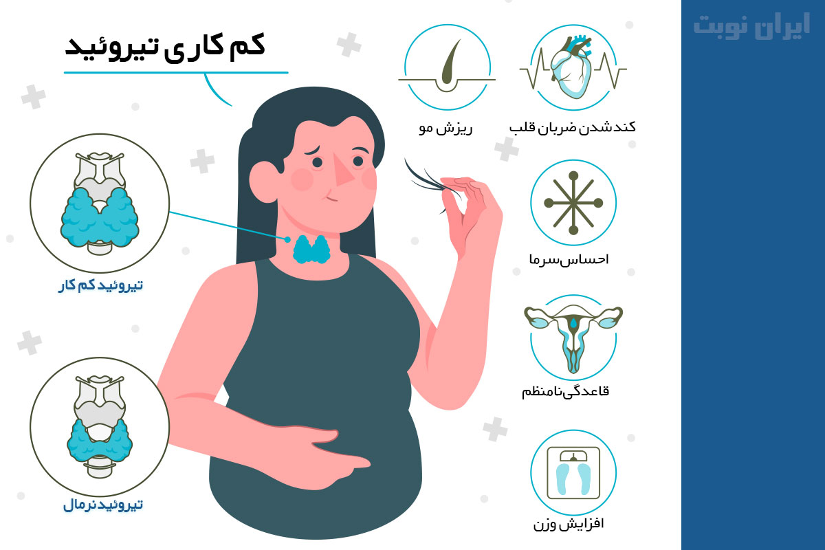 تیروئید کم‌کار چیست؟ علائم، علل، تشخیص و روش‌های درمان کم‌کاری تیروئید